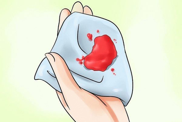 Кровянистые (кровяные) выделения из влагалища: мажущие вместо месячных