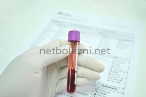Препараты для разжижения крови, список средств и лекарств разжижающих кровь и препятствующих тромбообразованию