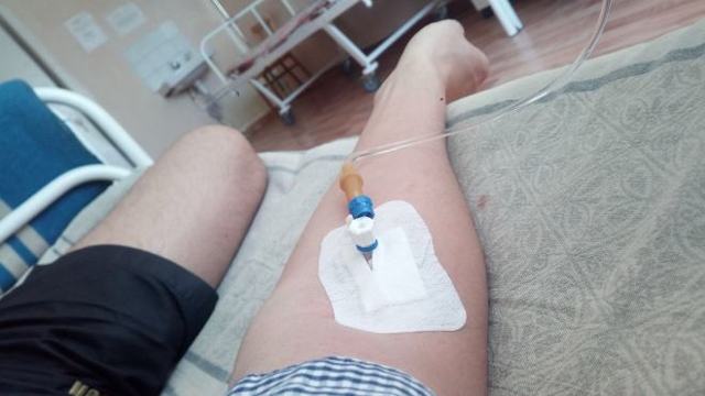 Постановка периферического катетера