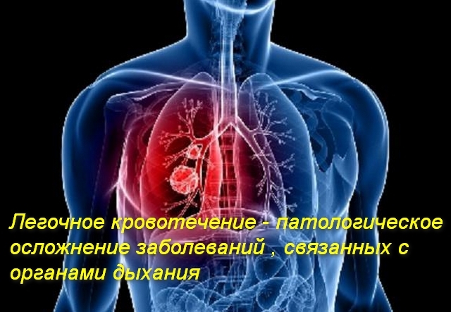 Признаки легочного кровотечения и неотложная помощь