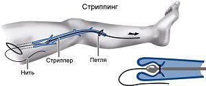 Почему вздуваются вены на руках и ногах: причины, лечение, профилактика