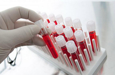 Общий белок в крови: норма у женщин и мужчин, причины повышенного и пониженного значения