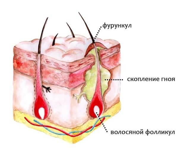 Линимент синтомицина - инструкция, применение, назначения