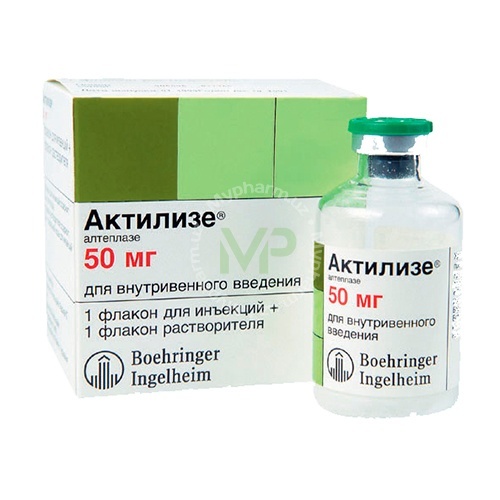 Ишемический инсульт - причины, симптомы, диагностика и лечение