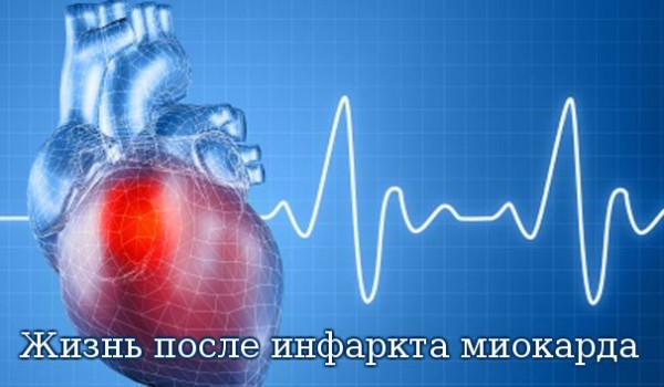 Как жить после инфаркта миокарда
