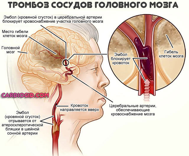 АПТВ анализ крови: что это, как сдавать, расшифровка