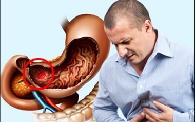 Основные признаки и симптомы внутреннего кровотечения