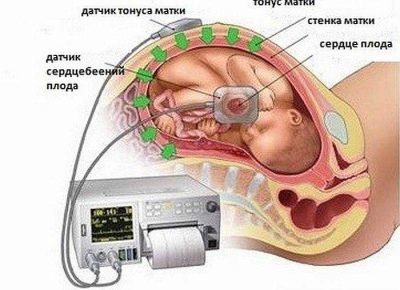 Норма пульса у женщин при беременности: по неделям и триместрам