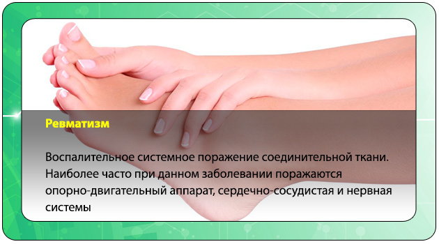 Как почистить сосуды ног от бляшек: обзор препаратов и народных средств