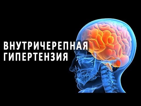 Гипертензионный синдром у детей и взрослых: симптомы, лечение