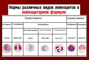 Как Повысить Лейкоциты в Крови