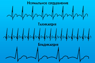 Пульс у спортсменов при нагрузке - Все про гипертонию