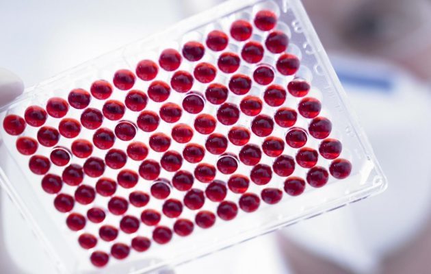 Анализ крови на билирубин - что это такое, как обозначается