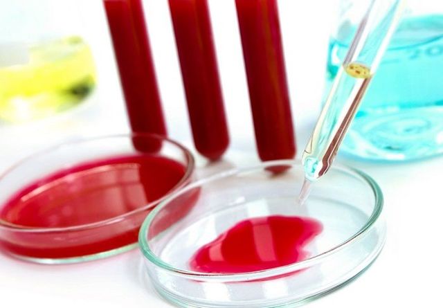 Анализ крови ПСА — что это такое? Расшифровка и норма