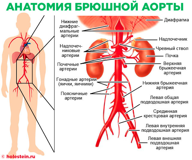 Атеросклероз брюшной аорты