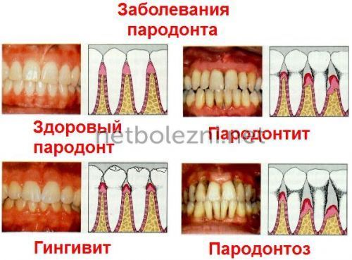 Густая, вязкая и тягучая слюна во рту: причины густой слюны, лечение