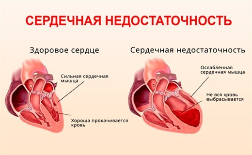 Таблетки Аскофен-п показания к применению