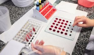 Как узнать свою группу крови: с помощью цоликлонов, стандартными сыворотками, алгоритм действий, инструменты и методы