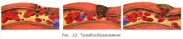 Диета при высоком гемоглобине
