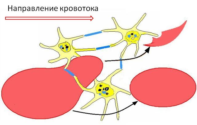 Шизоциты в крови - Все про гипертонию