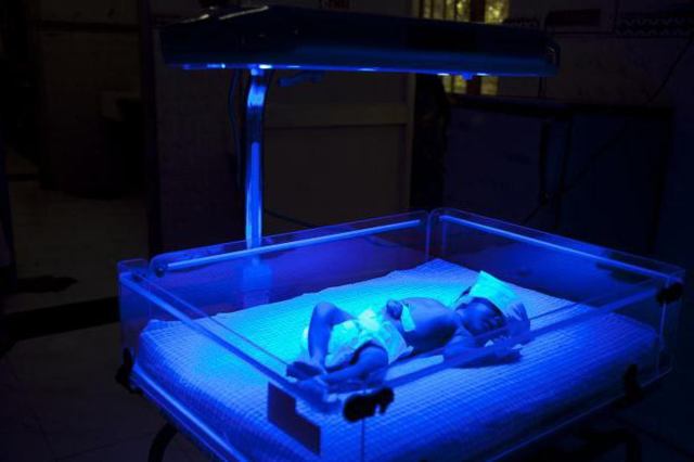 Повышен билирубин у взрослого или новорожденного - что это значит