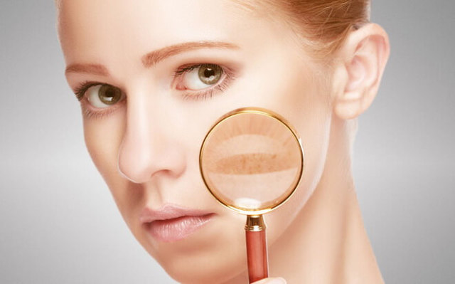 Системная красная волчанка при беременности. Системная красная волчанка и беременность