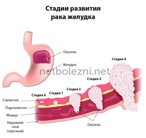 Кал черного цвета у взрослого - возможные причины