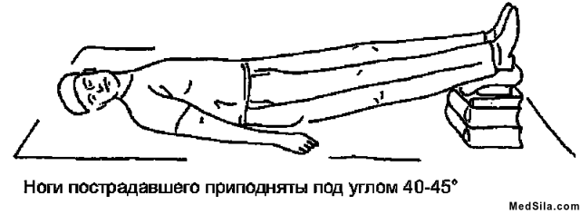Алгоритм проведения сердечно-легочной реанимации. Основы сердечно-легочной реанимации