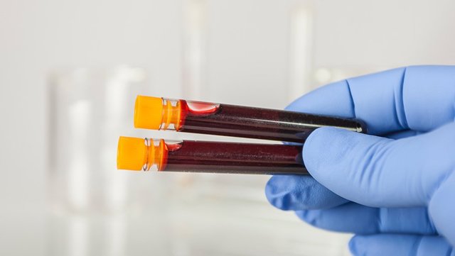 Что означает pdw в анализе крови и методы расшифровки