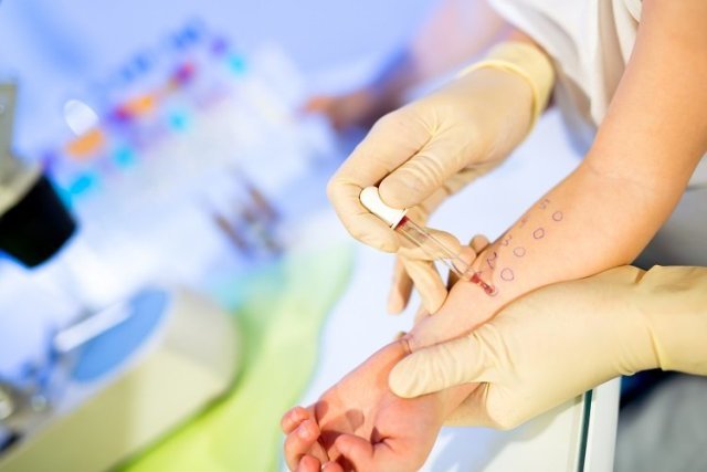 Аллергия после приема антибиотиков лечение — Аллергия