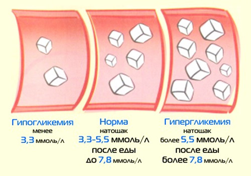 Уровень глюкозы в крови: норма