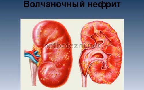Антикоагулянты – механизм действия, список препаратов