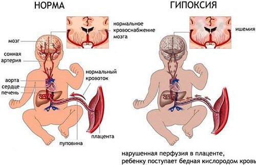 HCT в анализе крови – что это такое, что такое гематокрит в анализе крови? Низкий гематокрит, повышен гематокрит в крови