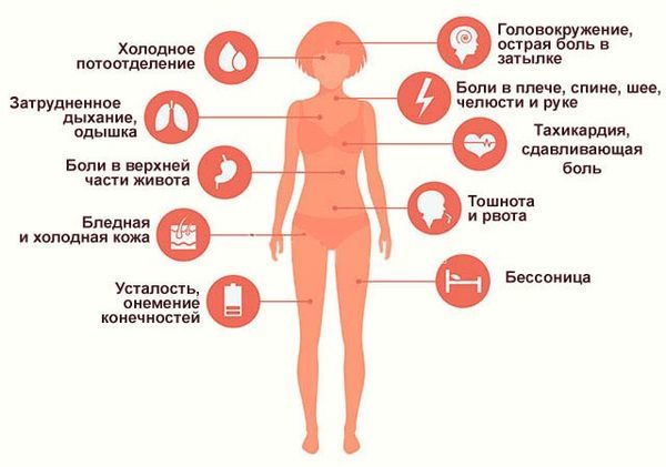 Инфаркт - симптомы и первые признаки инфаркта миокарда у женщин