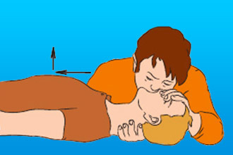 Закрытый массаж сердца., Методика выполнения закрытого массажа сердца - Основы реанимации