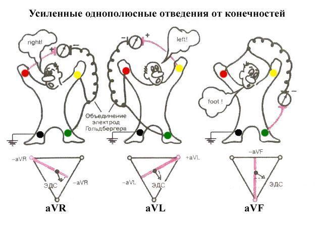 ЭКГ, электрокардиография: как делают кардиограмму, расшифровка электрокардиограммы