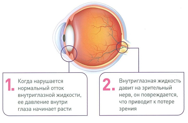 ТИМОЛОЛ - инструкция по применению, цена, аналоги, отзывы