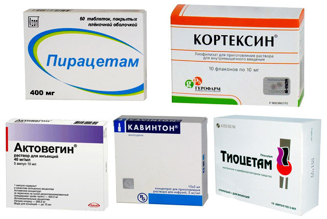 Ишемический инсульт: лечение и профилактика медикаментами