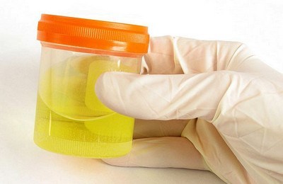 Креатинин в крови повышен: причины отклонения от нормы и способы снижения уровня креатинина