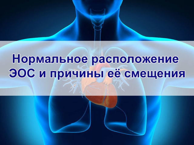 Ритм синусовый горизонтальное положение эос. Нормальное расположение эос и причины ее смещения