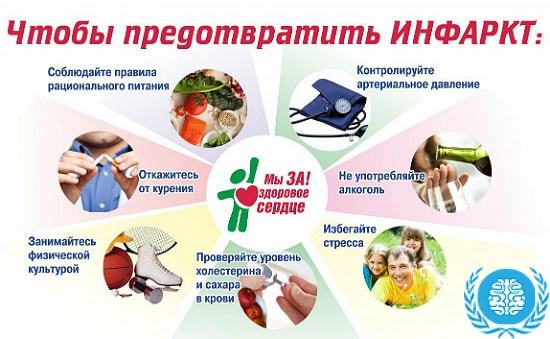 Инфаркт головного мозга - Мое Здоровье