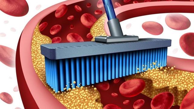 Как почистить сосуды в домашних условиях быстро и эффективно