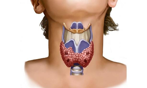 Давление 100 на 70: причины и лечение