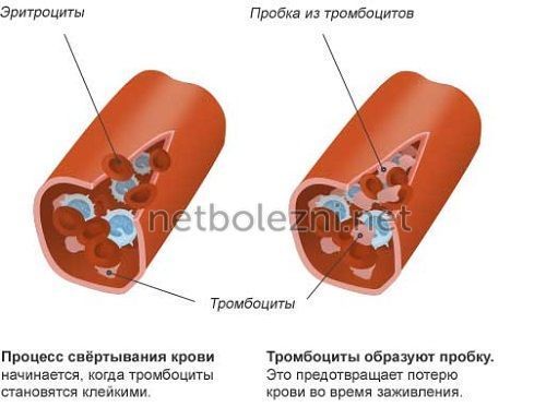Аспирин кардио от чего помогает? Что лучше Кардиомагнил или Аспирин
