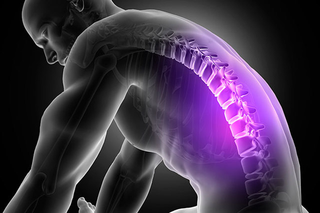 Инсульт спинного мозга (спинальный): симптомы, лечение, последствия