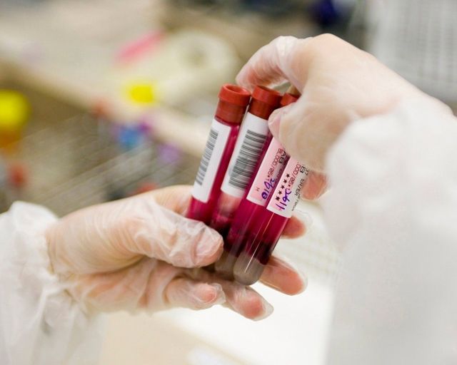 Какая норма МНО крови: анализ, расшифровка показателей, когда уровень МНО повышен и низкий, значение МНО при беременности
