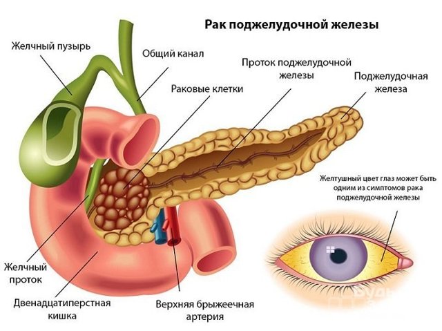 Онкомаркеры – расшифровка, таблица нормы