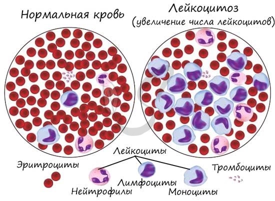 Иммунитет - материалы для подготовки к ЕГЭ по Биологии