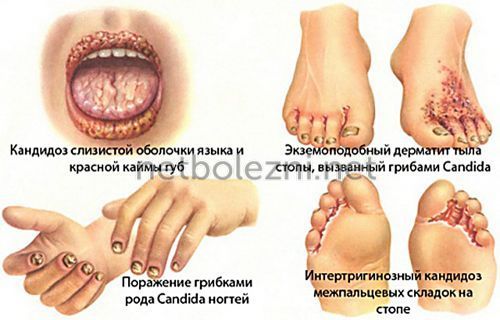 Густая, вязкая и тягучая слюна во рту: причины густой слюны, лечение