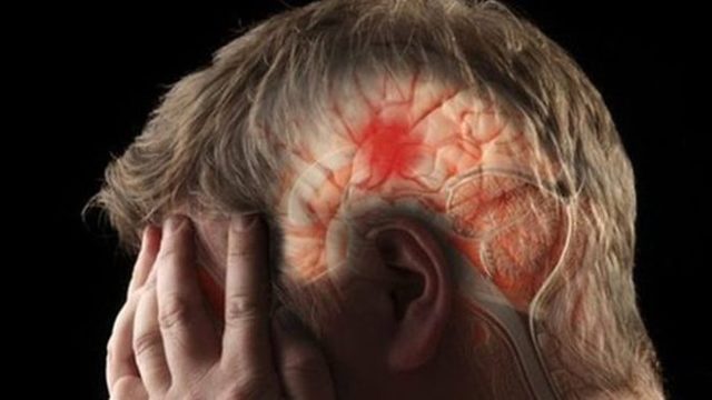 Фибриноген выше нормы – что это значит, что это такое, что делать? Фибриноген в крови – норма у женщин